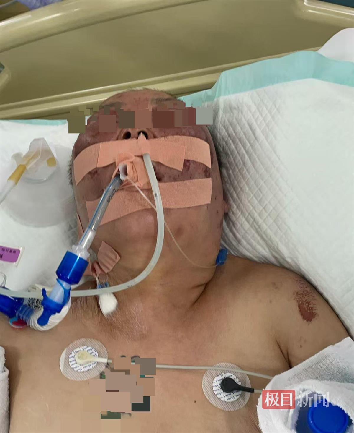 半岛体育-被前夫打进ICU的女子情况仍不稳定，其8岁女儿也曾遭父亲扇脸，律师：已构成故意伤害罪，或同时涉虐待罪
